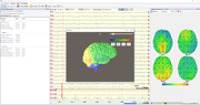 Электроэнцефалограф Компакт-нейро, 24 канала, шлем
