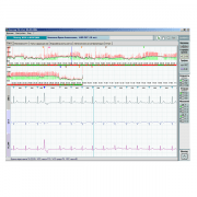 Суточный монитор холтер ЭКГ Валента МН-05
